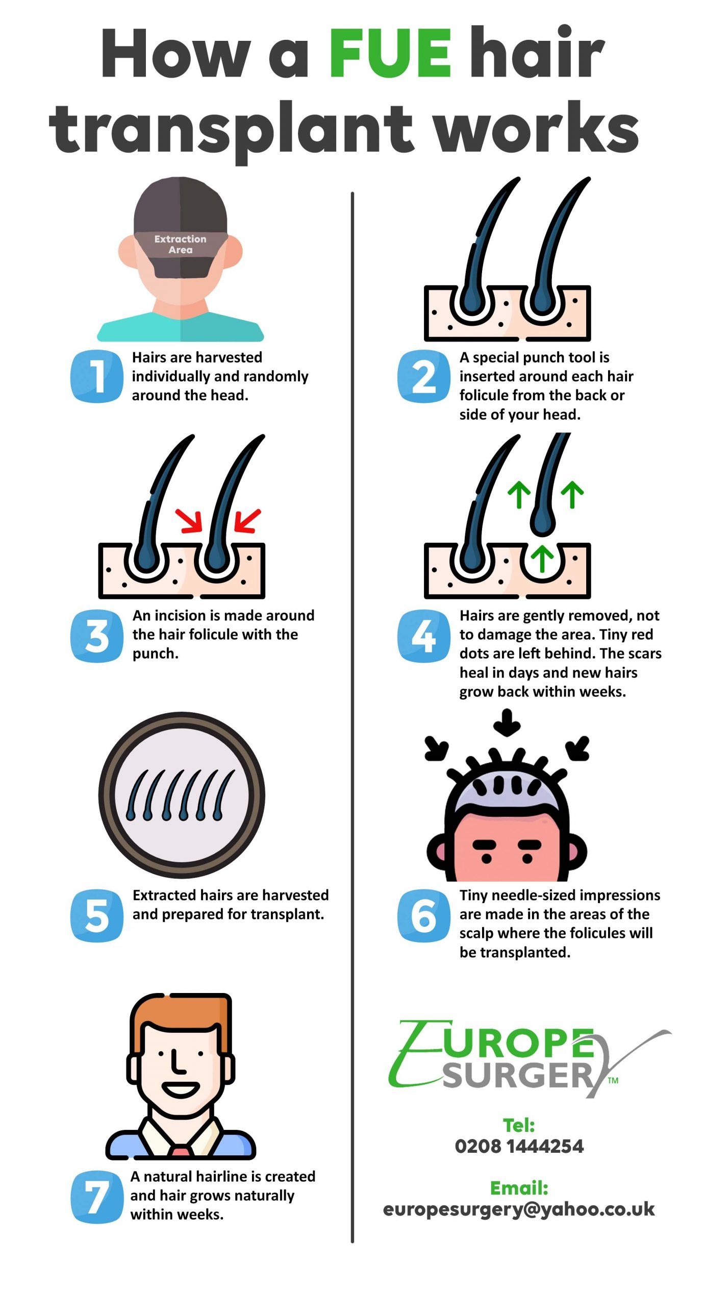 How does a hair transplant work? Your ultimate guide - Europe Surgery