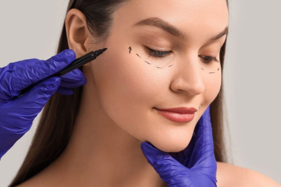 Woman being prepared for an eyelift surgery